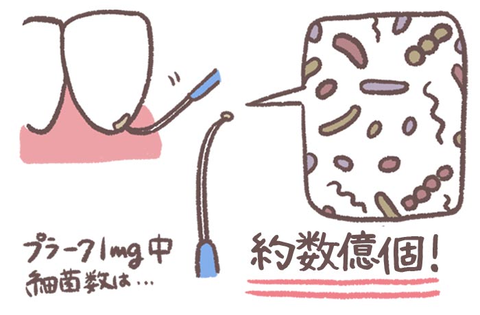 歯に付着したプラークのイメージ